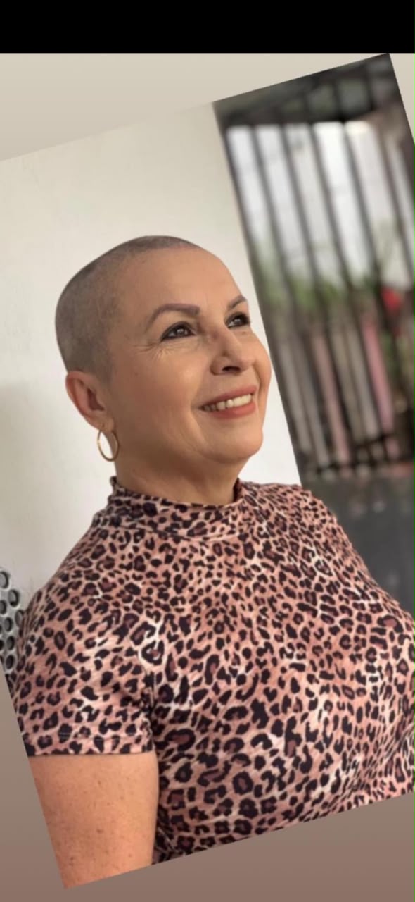 Palmareña sobreviviente de cáncer de mama.